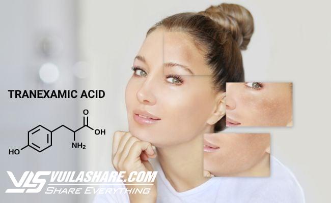 Tranexamic Acid là gì? Tác dụng với làn da và top 3 sản phẩm hiệu quả- Ảnh 1.