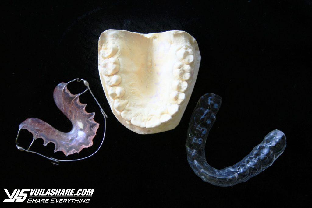 Chăm sóc hàm duy trì sau khi niềng răng hiệu quả nhất từ nha sĩ- Ảnh 4.
