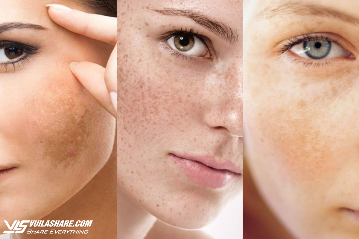 Review kem trị nám Image Skincare có tốt không và top sản phẩm bán chạy- Ảnh 4.