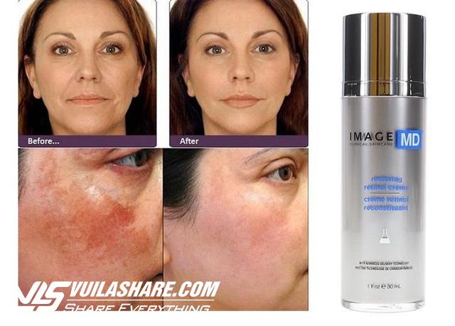 Review kem trị nám Image Skincare có tốt không và top sản phẩm bán chạy- Ảnh 6.