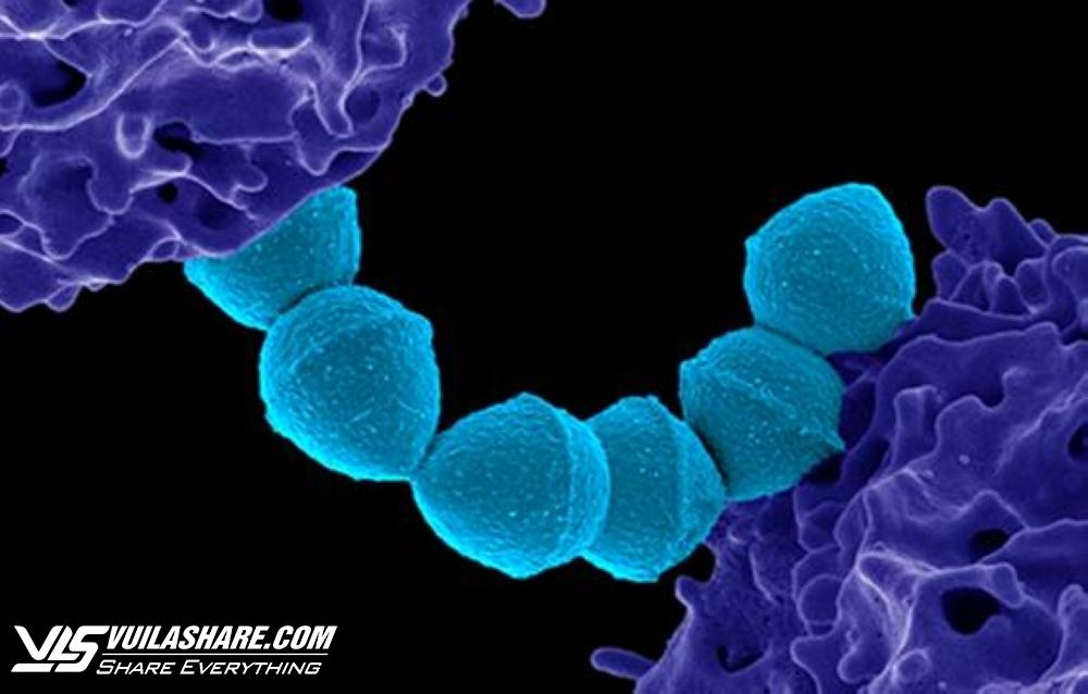 Ca nhiễm vi khuẩn 'ăn thịt người' tăng mạnh ở Nhật Bản, có người tử vong trong 2 ngày- Ảnh 1.